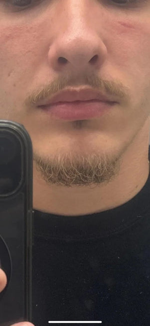 Reverse beard review 1