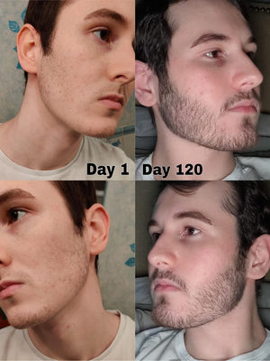 Reverse beard review 03